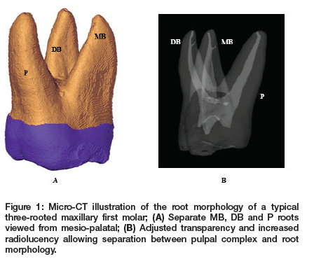 Root And Canal Morphology Of The Maxillary First Molar A Micro Root And Canal Morphology Of The Maxillary First Molar A Micro